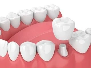 Crown 3D Graphics for article