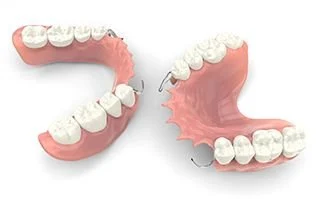 Partial Dentures Graphics