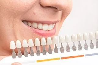 Teeth Whitening Checking