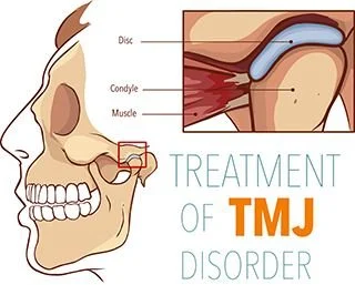 Graphical representation of TMD