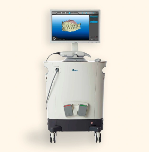 iTero digital impression system with scanning wand and monitor displaying a 3D model of teeth.