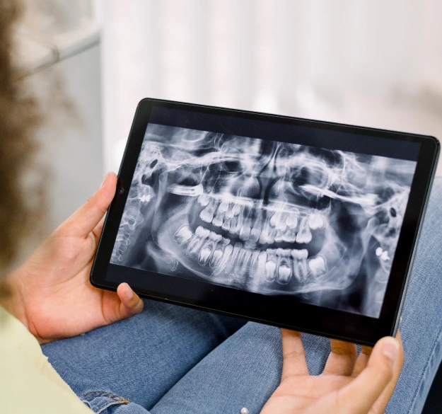 Person holding a tablet displaying a full-mouth panoramic dental X-ray.