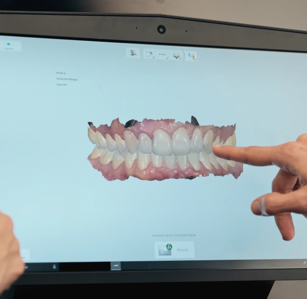 Dentist pointing to a digital 3D scan of a patient's teeth and gums displayed on a computer monitor.