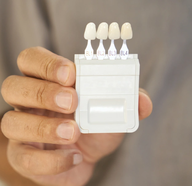 Hand holding a dental shade guide with four porcelain veneer color samples labeled BL1 through BL4