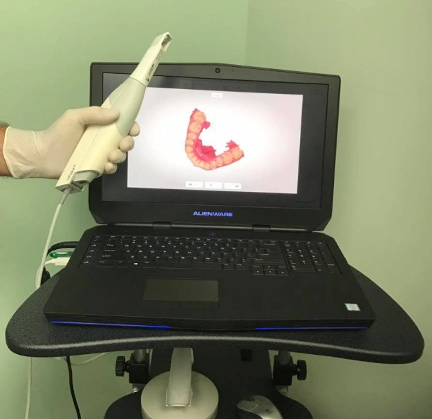 Dental professional holding a digital scanning wand connected to a laptop, with a 3D image of a lower dental arch on screen.